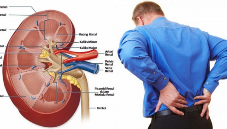 Ini Cara Menjaga Ginjal Dengan Baik –